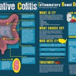 dieta colitis ulcerosa