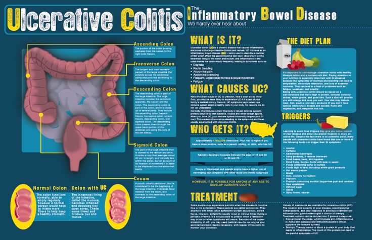 dieta colitis ulcerosa